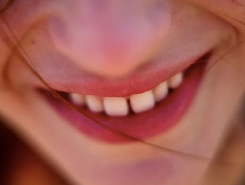 Video Content_Merck Smile